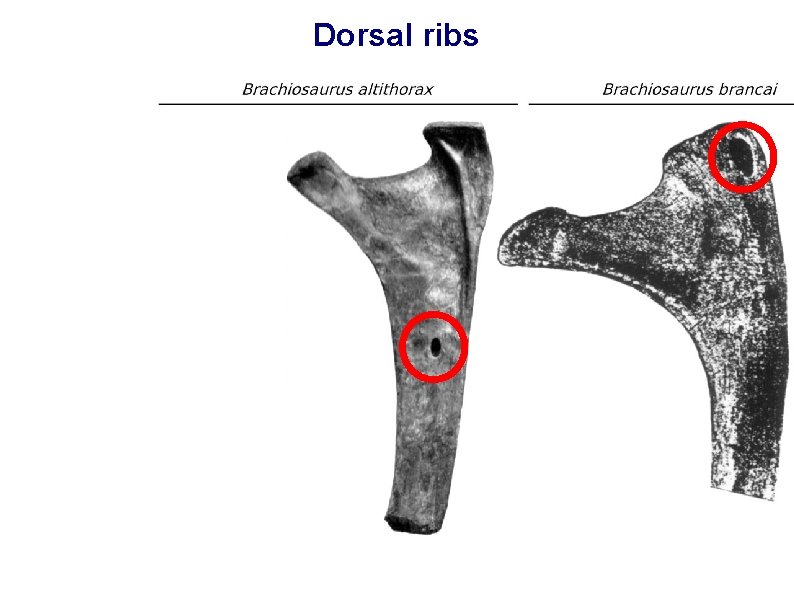 Dorsal ribs 