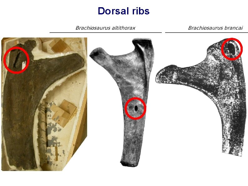 Dorsal ribs 