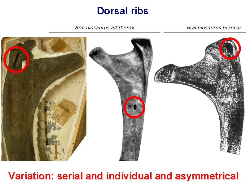 Dorsal ribs Variation: serial and individual and asymmetrical 