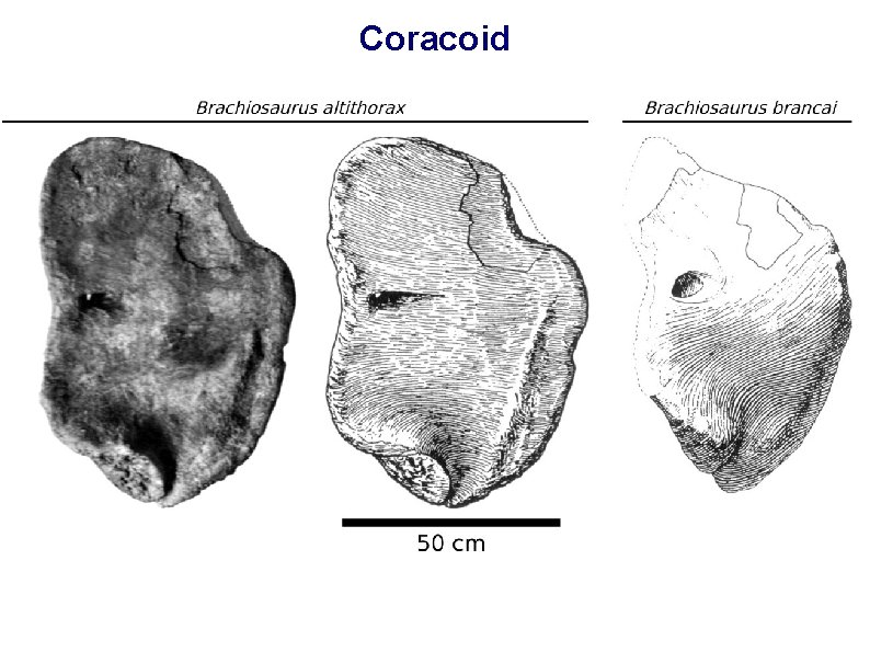 Coracoid 