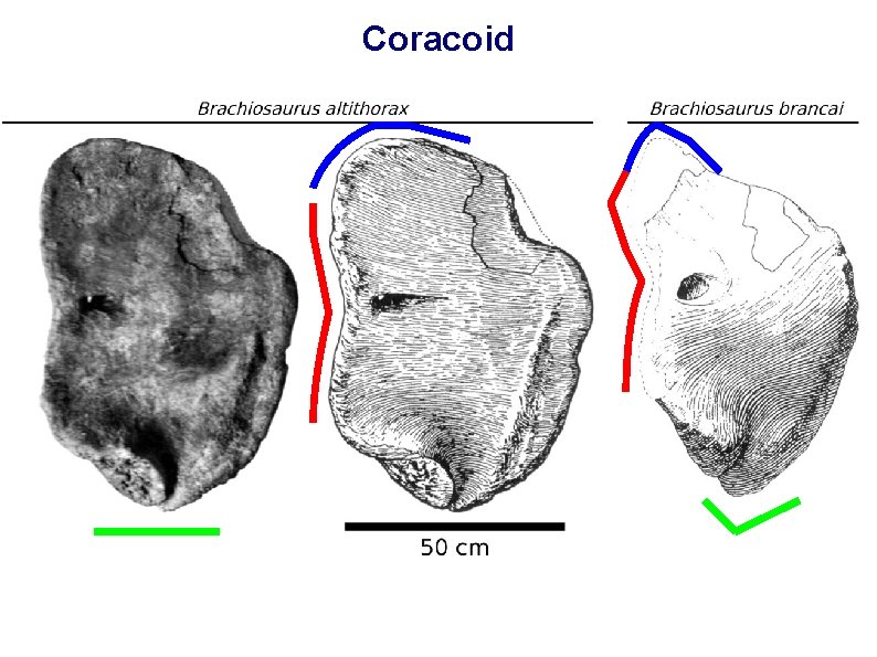 Coracoid 