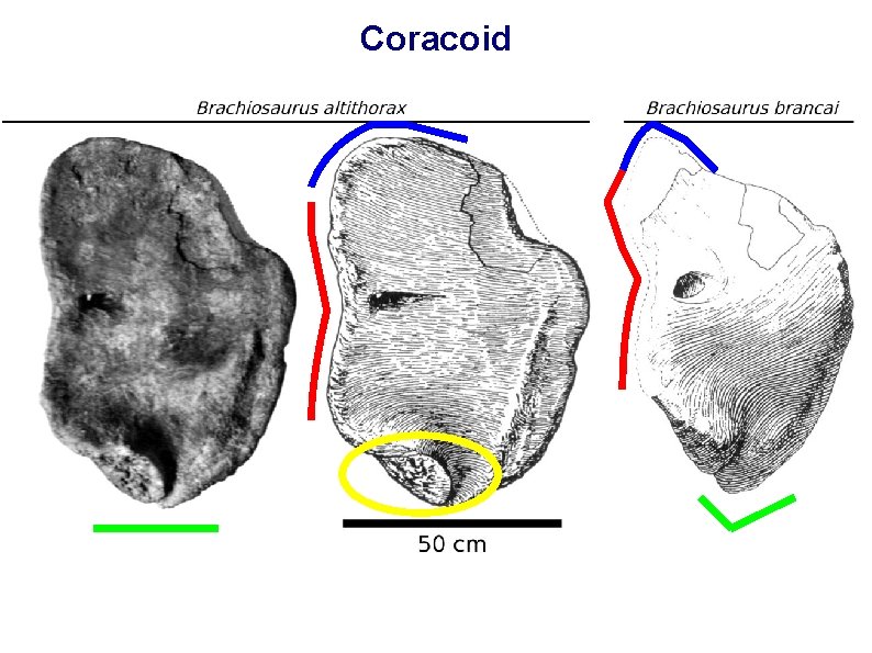 Coracoid 