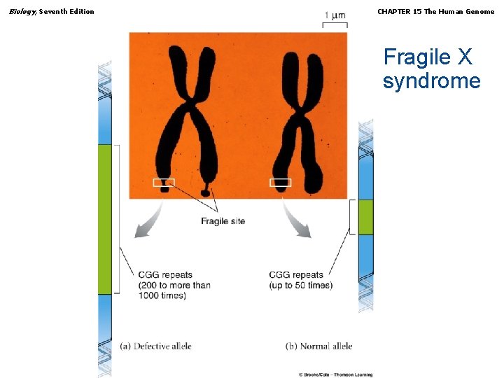 Biology, Seventh Edition CHAPTER 15 The Human Genome Fragile X syndrome Copyright © 2005