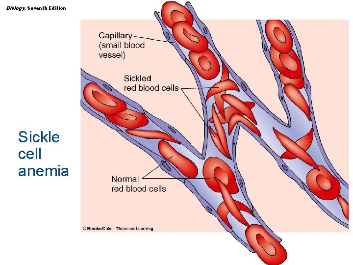 Biology, Seventh Edition CHAPTER 15 The Human Genome Sickle cell anemia Copyright © 2005