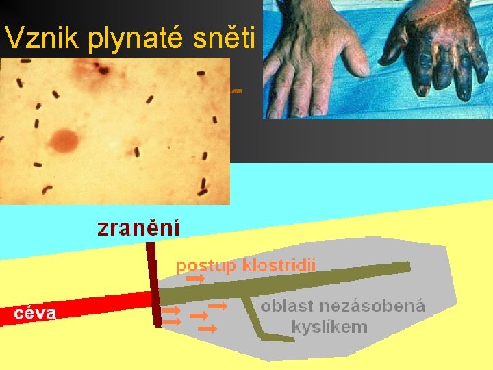 Vznik plynaté sněti 