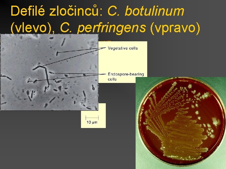Defilé zločinců: C. botulinum (vlevo), C. perfringens (vpravo) 