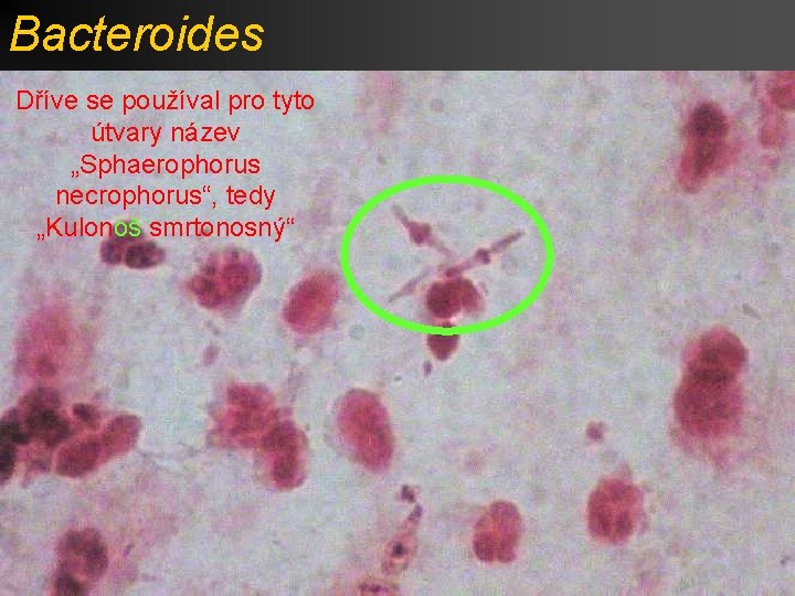 Bacteroides Dříve se používal pro tyto útvary název „Sphaerophorus necrophorus“, tedy „Kulonoš smrtonosný“ 