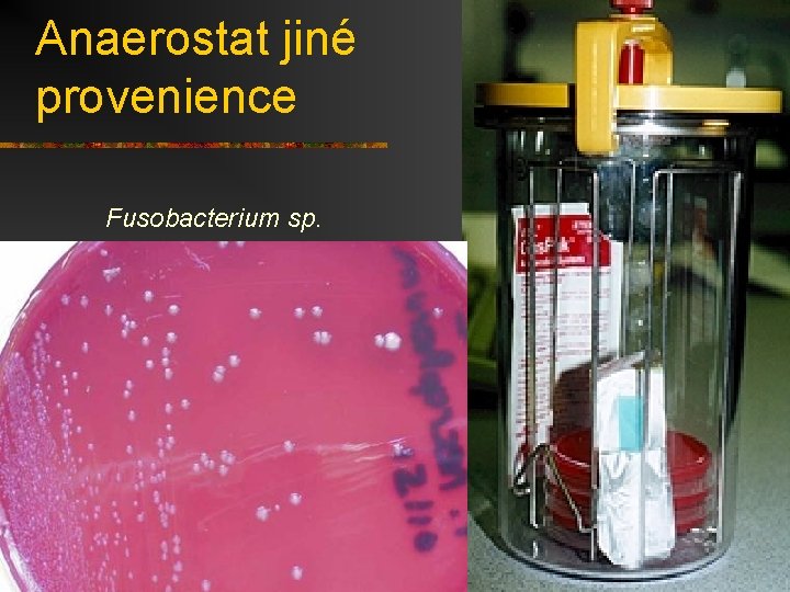 Anaerostat jiné provenience Fusobacterium sp. 