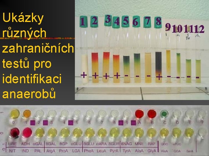 Ukázky různých zahraničních testů pro identifikaci anaerobů 