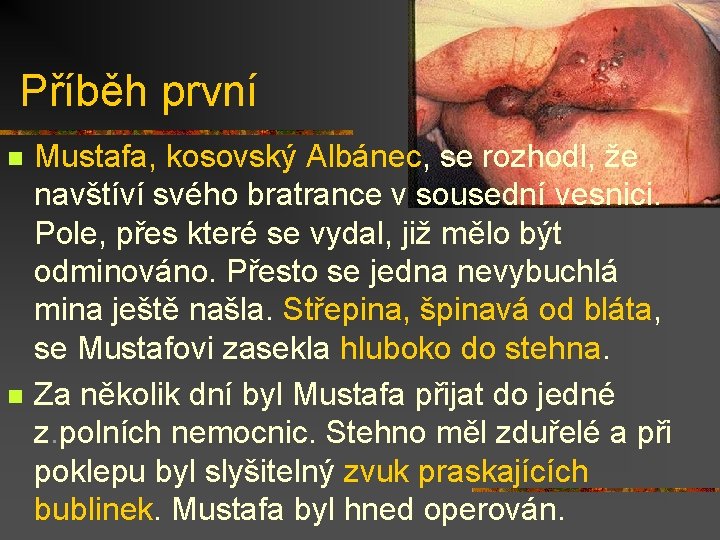 Příběh první n n Mustafa, kosovský Albánec, se rozhodl, že navštíví svého bratrance v