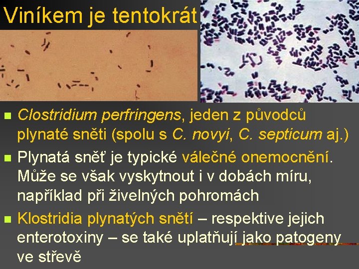 Viníkem je tentokrát n n n Clostridium perfringens, jeden z původců plynaté sněti (spolu