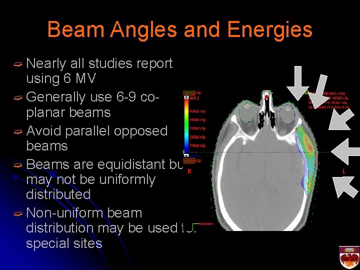 Beam Angles and Energies ➫ Nearly all studies report using 6 MV ➫ Generally