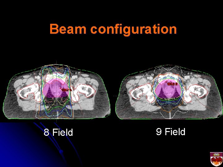 Beam configuration 8 Field 9 Field 