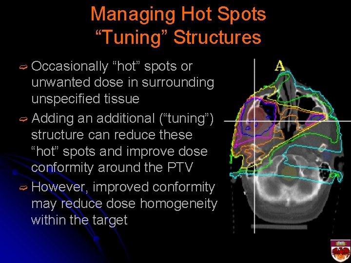 Managing Hot Spots “Tuning” Structures ➫ Occasionally “hot” spots or unwanted dose in surrounding