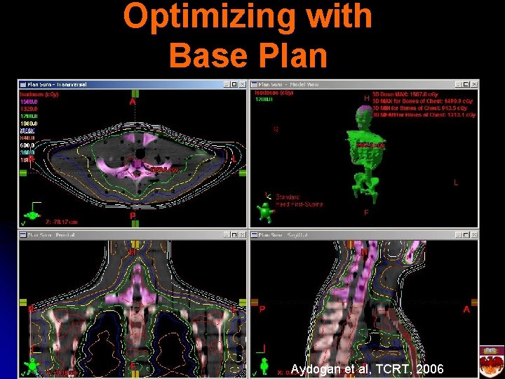 Optimizing with Base Plan Aydogan et al, TCRT, 2006 