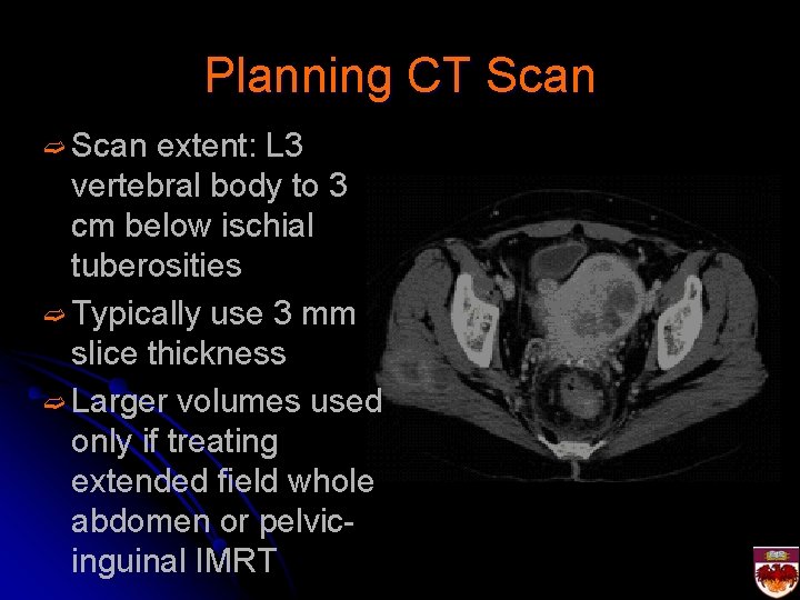 Planning CT Scan ➫ Scan extent: L 3 vertebral body to 3 cm below