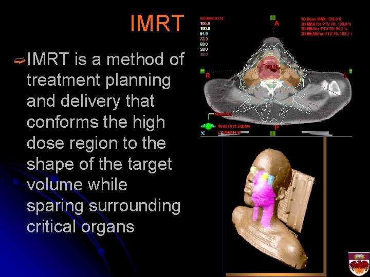 IMRT ➫ IMRT is a method of treatment planning and delivery that conforms the