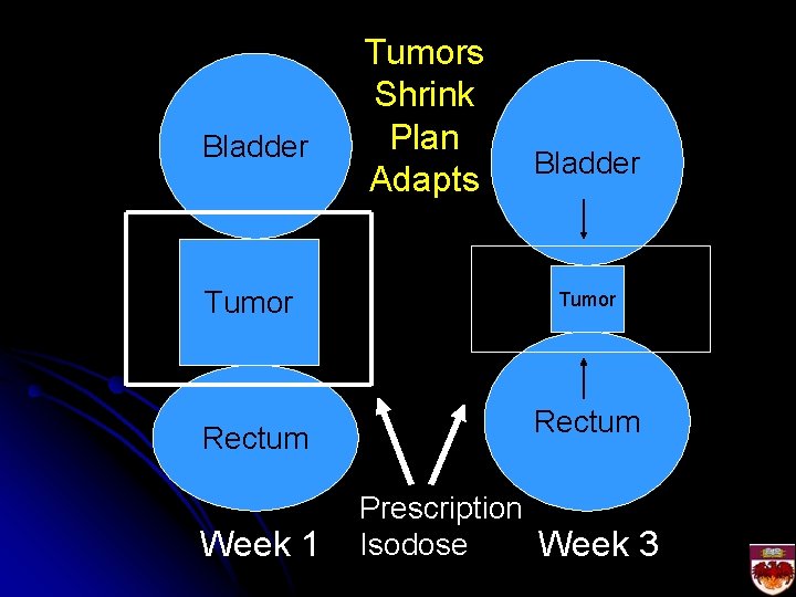 Bladder Tumor Rectum Week 1 Tumors Shrink Plan Adapts Bladder Tumor Rectum Prescription Isodose