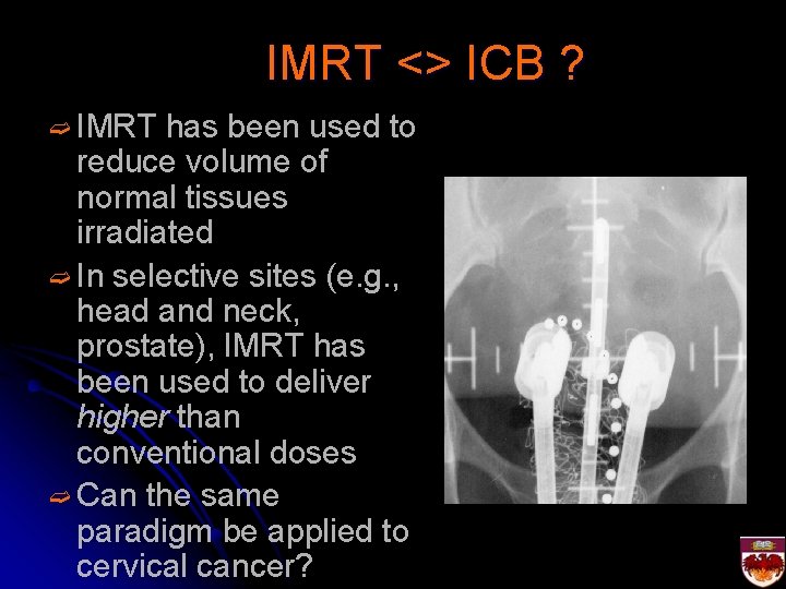 IMRT <> ICB ? ➫ IMRT has been used to reduce volume of normal