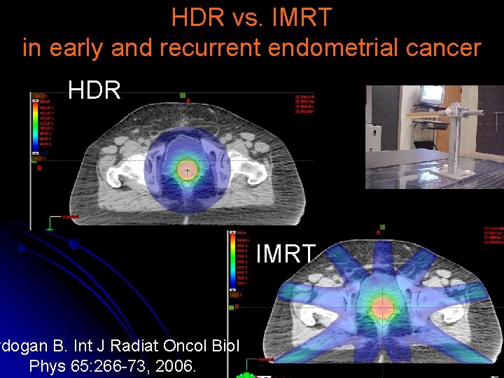 HDR vs. IMRT in early and recurrent endometrial cancer HDR ydogan B. Int J