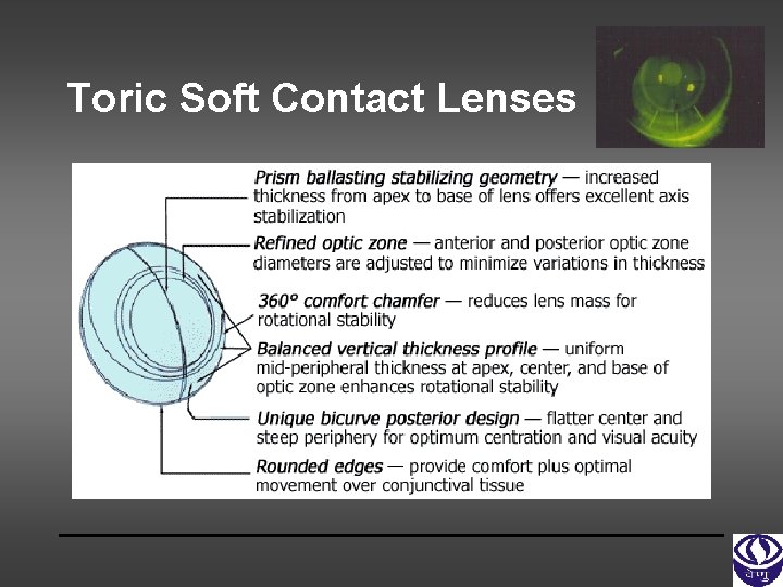 Toric Soft Contact Lenses 