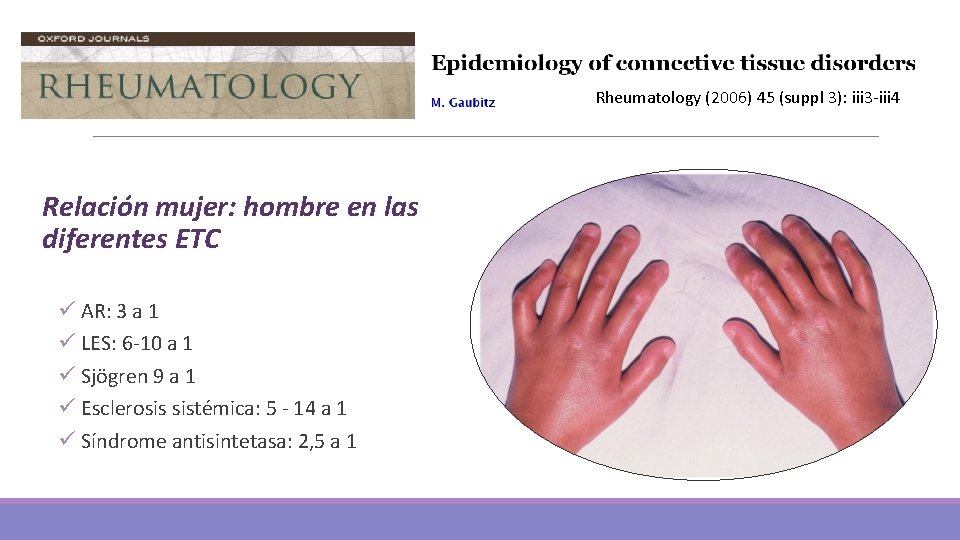 Rheumatology (2006) 45 (suppl 3): iii 3 -iii 4 Relación mujer: hombre en las