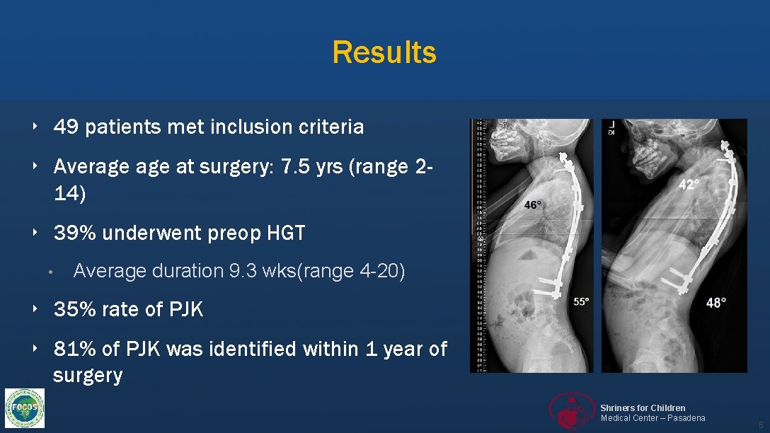 Results ‣ 49 patients met inclusion criteria ‣ Average at surgery: 7. 5 yrs