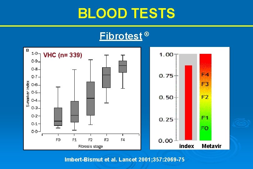BLOOD TESTS Fibrotest ® VHC (n= 339) index Imbert-Bismut et al. Lancet 2001; 357: