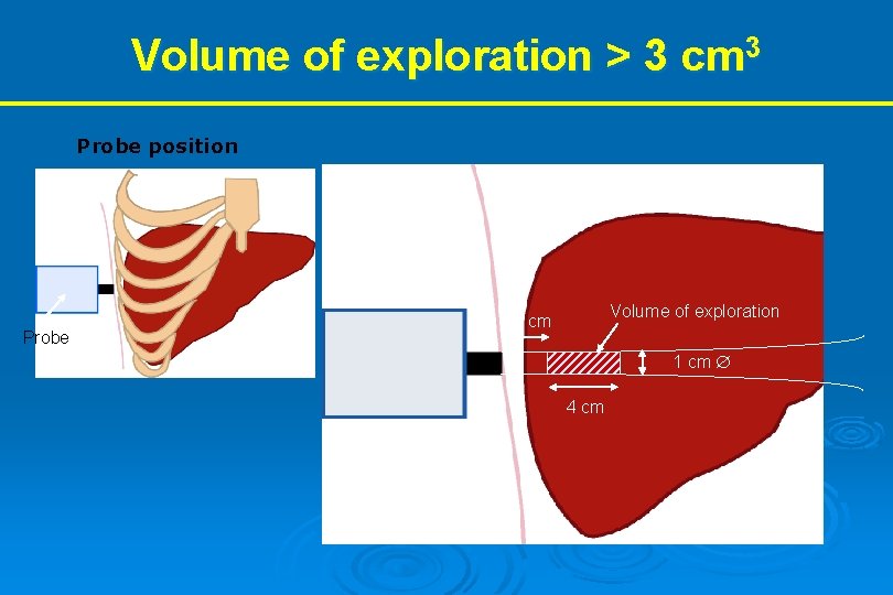 Volume of exploration > 3 cm 3 Probe position Probe Volume of exploration 2.