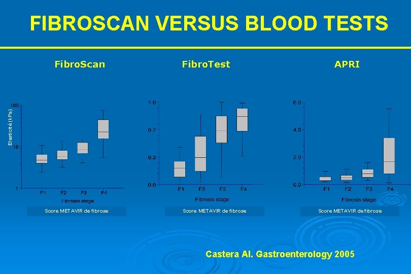 FIBROSCAN VERSUS BLOOD TESTS Fibro. Test APRI Elasticité (k. Pa) Fibro. Scan Score METAVIR