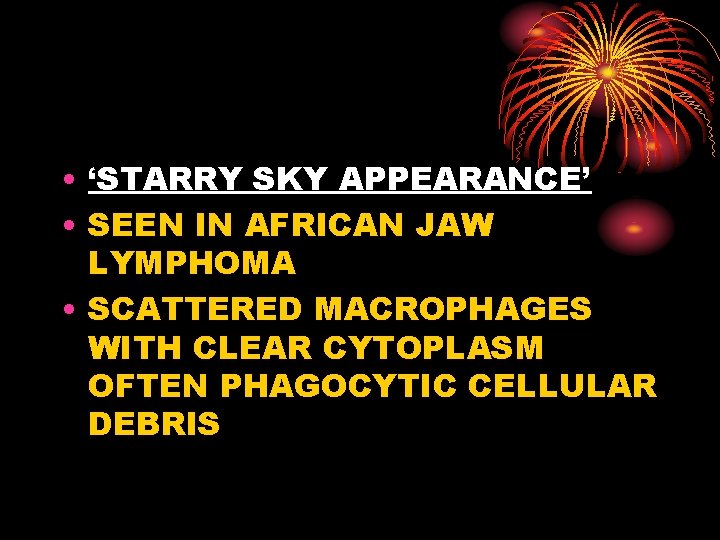  • ‘STARRY SKY APPEARANCE’ • SEEN IN AFRICAN JAW LYMPHOMA • SCATTERED MACROPHAGES