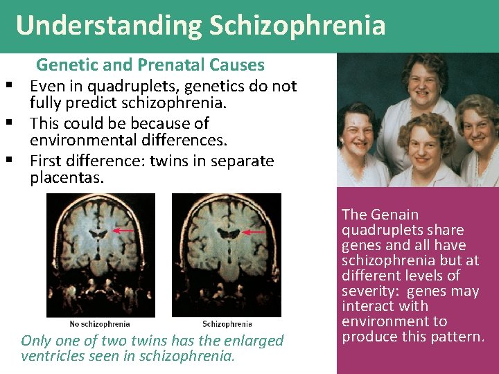 Understanding Schizophrenia Genetic and Prenatal Causes § Even in quadruplets, genetics do not fully