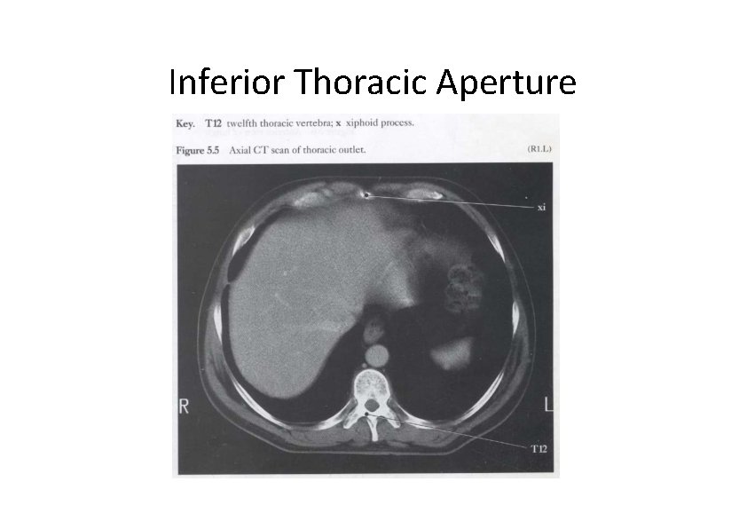 Inferior Thoracic Aperture 