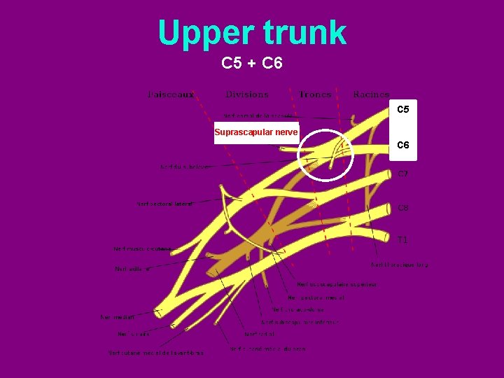 Upper trunk C 5 + C 6 C 5 Suprascapular nerve C 6 