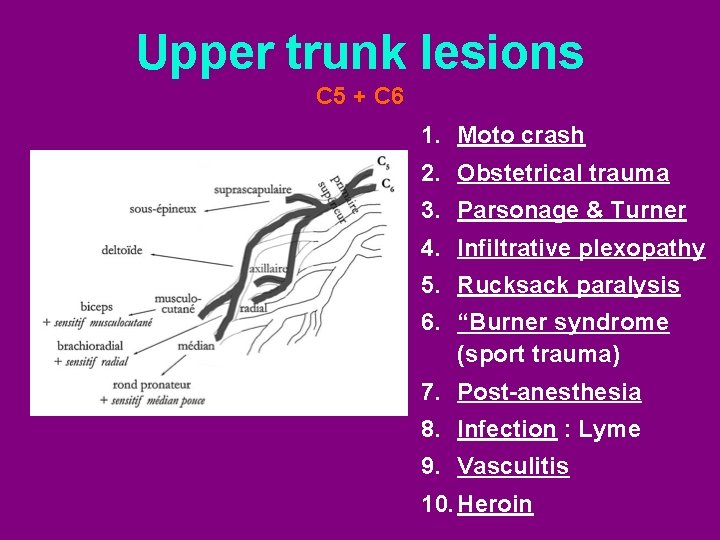 Upper trunk lesions C 5 + C 6 1. Moto crash 2. Obstetrical trauma