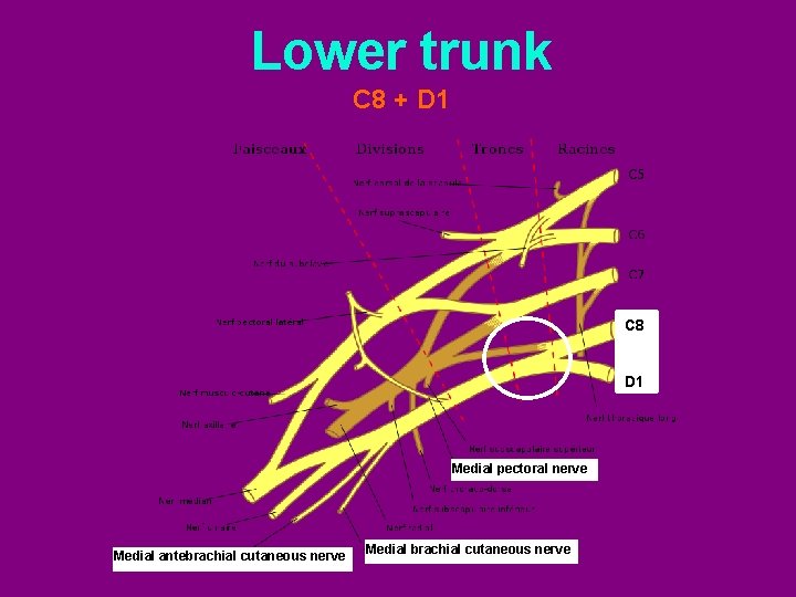 Lower trunk C 8 + D 1 C 8 D 1 Medial pectoral nerve