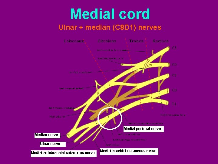 Medial cord Ulnar + median (C 8 D 1) nerves Medial pectoral nerve Median
