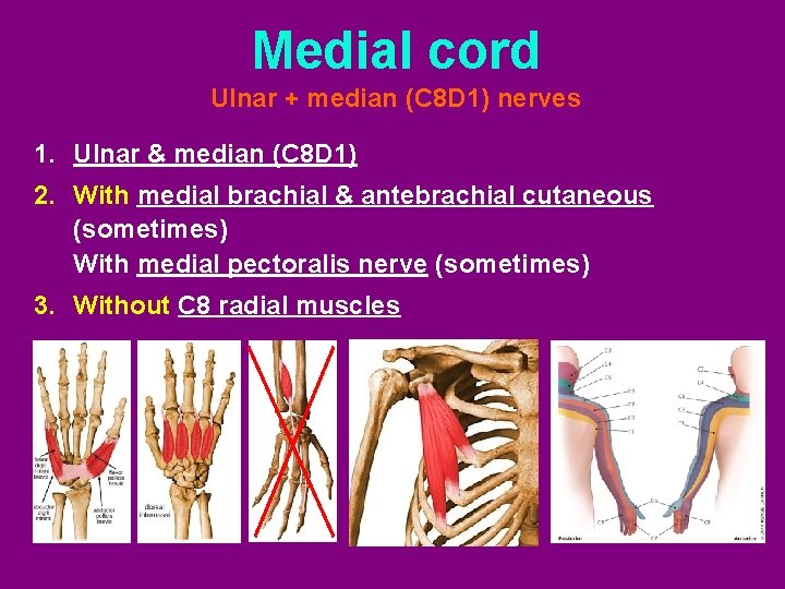 Medial cord Ulnar + median (C 8 D 1) nerves 1. Ulnar & median