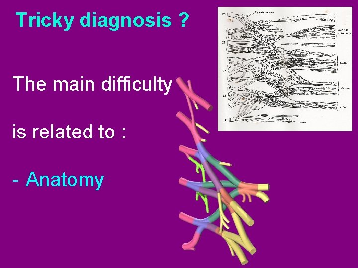Tricky diagnosis ? The main difficulty is related to : - Anatomy 