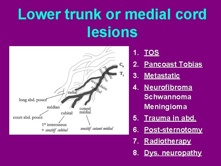 Lower trunk or medial cord lesions 1. TOS 2. Pancoast Tobias 3. Metastatic 4.