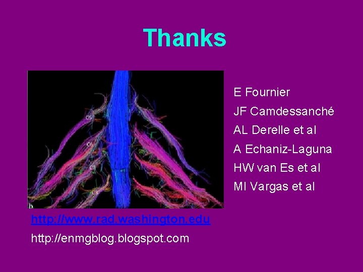 Thanks E Fournier JF Camdessanché AL Derelle et al A Echaniz-Laguna HW van Es