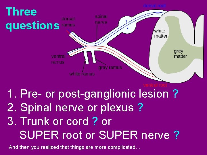 Three questions 1. Pre- or post-ganglionic lesion ? 2. Spinal nerve or plexus ?