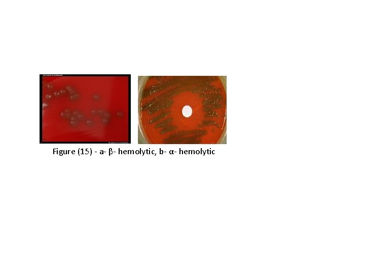 Figure (15) - a- β- hemolytic, b- α- hemolytic 