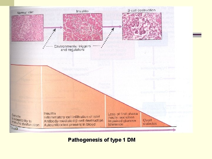 Pathogenesis of type 1 DM 