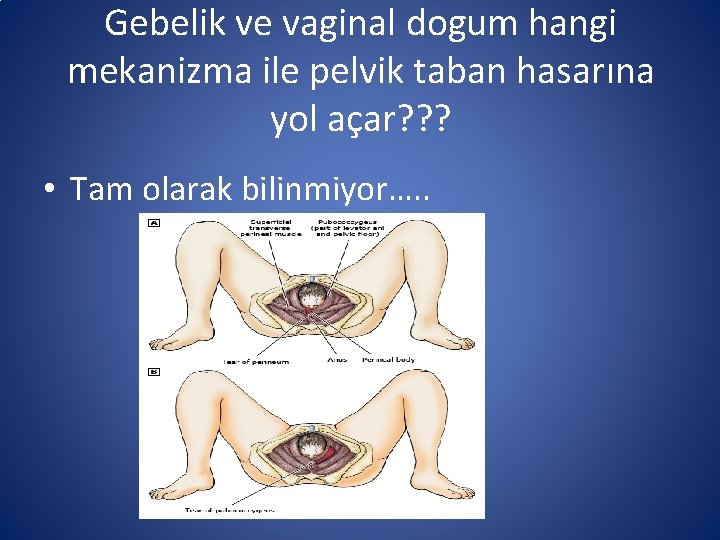 Gebelik ve vaginal dogum hangi mekanizma ile pelvik taban hasarına yol açar? ? ?