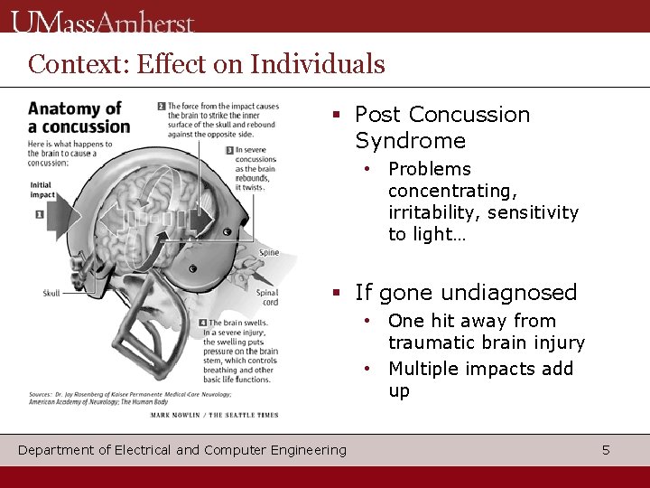 Context: Effect on Individuals Post Concussion Syndrome • Problems concentrating, irritability, sensitivity to light…