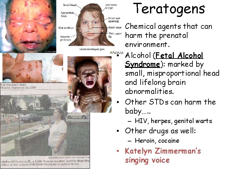Teratogens • Chemical agents that can harm the prenatal environment. • Alcohol (Fetal Alcohol
