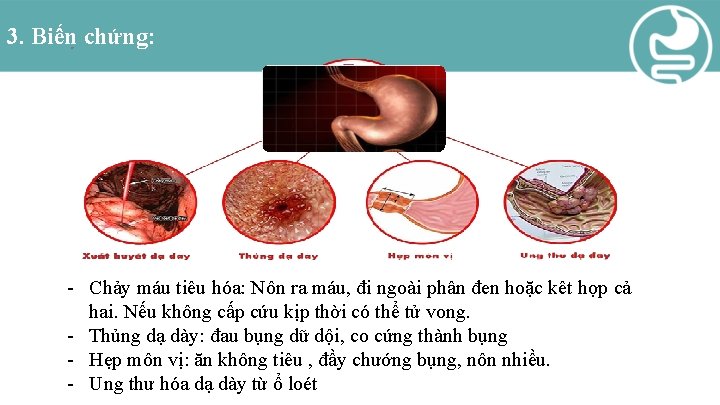 3. Biến chứng: - Chảy máu tiêu hóa: Nôn ra máu, đi ngoài phân