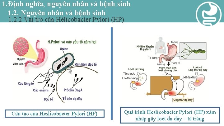 1. Định nghĩa, nguyên nhân và bệnh sinh 1. 2. Nguyên nhân và bệnh
