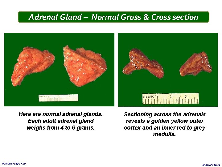 Adrenal Gland – Normal Gross & Cross section Here are normal adrenal glands. Each Adrenal Gland – Normal Gross & Cross section Here are normal adrenal glands. Each